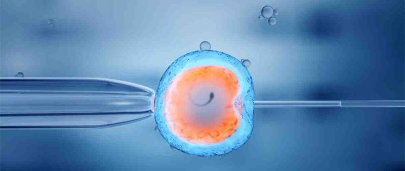 Does IVF Create More Problems than it Solves