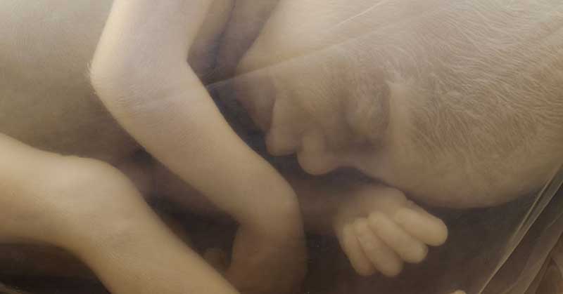 Fetus in womb